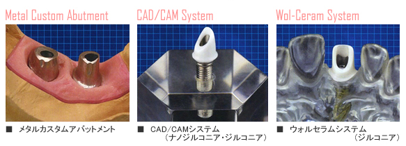 カスタムアパットメント図解