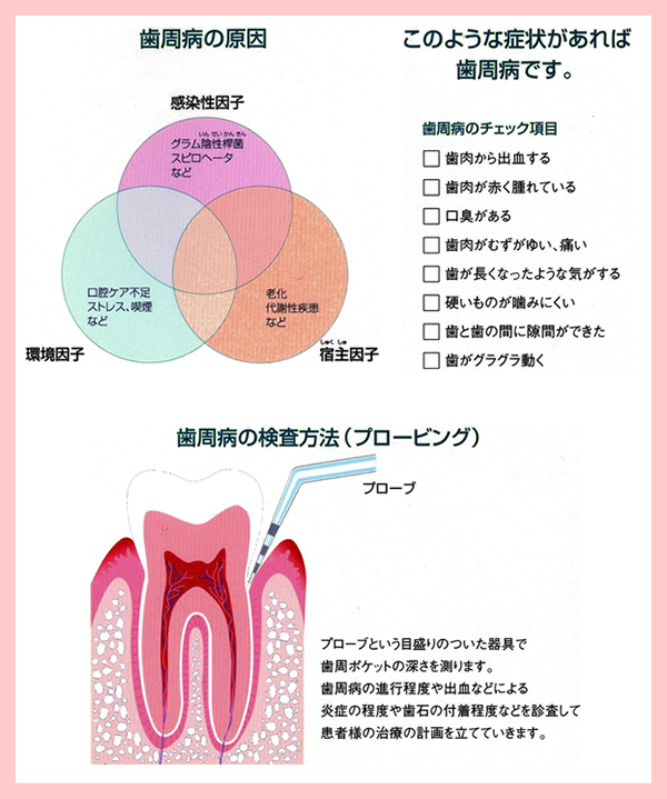 歯周病の原因