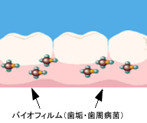 バイオフィルム